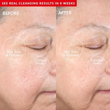 PMD Clean Redvolution Facial Cleansing Device for All Ages