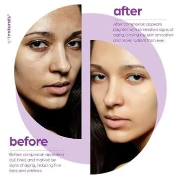 ArtNaturals Retinol Serum for Face - with Vitamin C, 2.5% Retinol Oil & Hyaluronic-Acid - Skin Clearing - Anti-Aging, Anti-Wrinkle Eye Serum - Skin Repair, Night Therapy (1 Fl Oz / 30ml) (ANGA-0127)