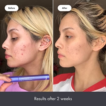 Hero Cosmetics Lightning Wand Brightening Serum for Skin