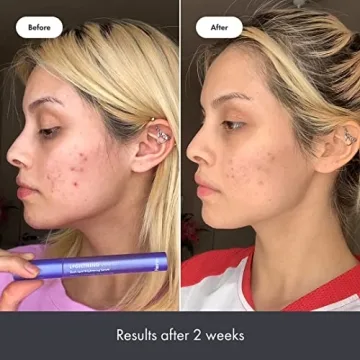 Hero Cosmetics Lightning Wand Brightening Serum for Skin