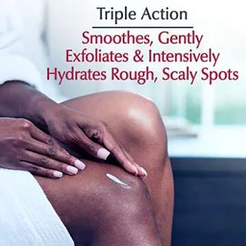 Eucerin Roughness Relief Spot Treatment, Urea Enriched Body Moisturizer for Dry Skin, Rough and Scal...