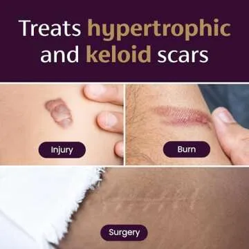 Mederma Silicone Scar Sheets for Effective Scar Treatment