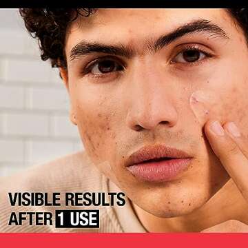 Neutrogena Stubborn Acne Pimple Patches, Acne Treatment for Face, Ultra-Thin Hydrocolloid Patches Pr...