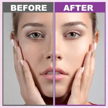 Anti-Aging Skin Care Kit for Women - Gift Set