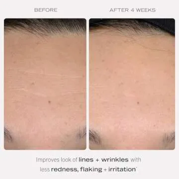 First Aid Beauty - 0.3% Retinol Complex Serum with Peptides, Designed for Sensitive Skin, Helps Visibly Improve Lines and Wrinkles with Less Irritation than Traditional Retinol, Non-Comedogenic, 1 oz