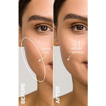 DERMAFlASH LUXE Sonic Edge Anti-Aging Exfoliation Tool