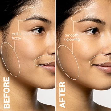 DERMAFlASH LUXE Sonic Edge Anti-Aging Exfoliation Tool