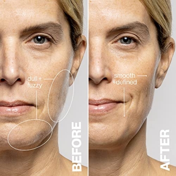 DERMAFlASH LUXE Sonic Edge Anti-Aging Exfoliation Tool