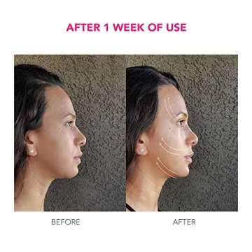 FOREO Age-Defying Bear Bundle - Instant Face Lift Set