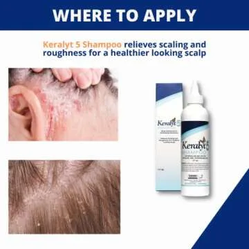 Keralyt 5 Anti-Dandruff Shampoo - Maximum Relief Formula