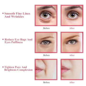 Ice Globes for Facials, Women's Face Globes, Facial Massager Skincare Tool for Daily Beauty Skin Care, Reduce Puffiness and Relief Migraine, Pain