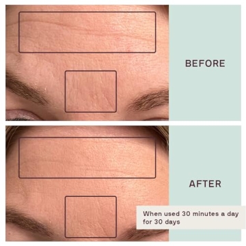 Dermaclara Silicone Patches for Forehead Wrinkles - Reusable