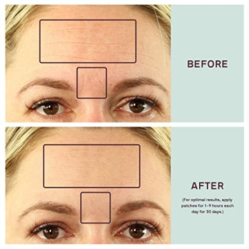 Dermaclara Silicone Patches for Forehead Wrinkles - Reusable