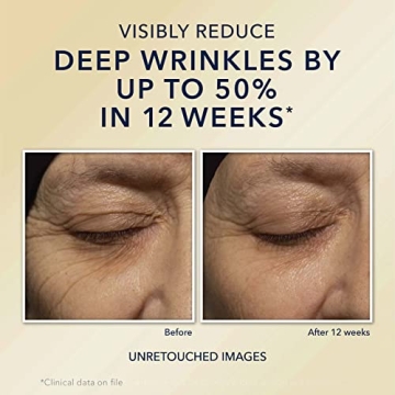 RoC Night Cream for Effective Anti-Aging & Hydration