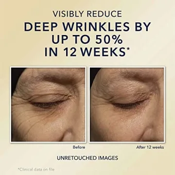 RoC Night Cream for Effective Anti-Aging & Hydration