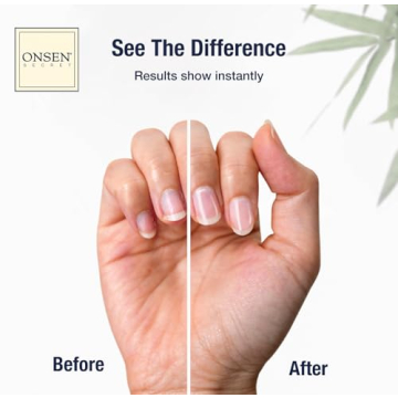 Onsen Nail & Cuticle Cream – Heal & Nourish Your Nails