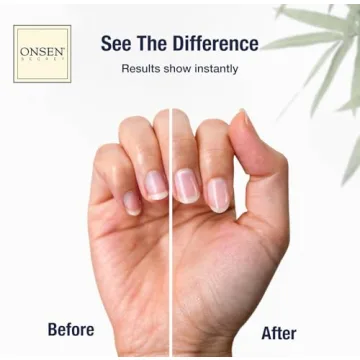 Onsen Nail & Cuticle Cream – Heal & Nourish Your Nails