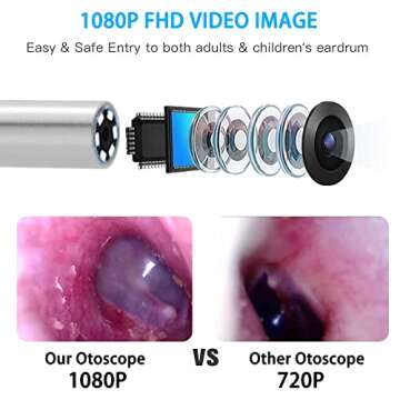 Ear Wax Removal Endoscope Otoscope, Earwax Remover Tools, Scope, with 1080P FHD Camera, 6 Led Lights, Wireless Connected, Compatible with iPhone, iPad, Android Smart Phones & Tablets (White)
