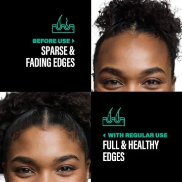 Organic Batana Oil for Hair Growth - Authentic 4 Ounce Jar