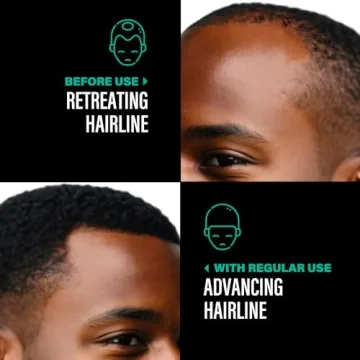 Organic Batana Oil for Hair Growth - Authentic 4 Ounce Jar