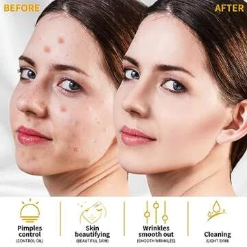 MYSWEETY High Frequency Skin Care Wand - Effective & Portable