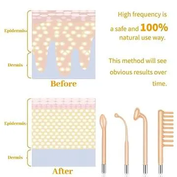 MYSWEETY High Frequency Skin Care Wand - Effective & Portable