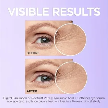 L'Oreal Revitalift Hyaluronic Acid Eye Serum for Dark Circles