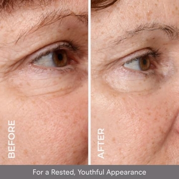 COSMEDIX Opti Crystal Eye Serum for Dark Circles & Puffiness