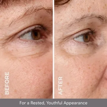 COSMEDIX Opti Crystal Eye Serum for Dark Circles & Puffiness