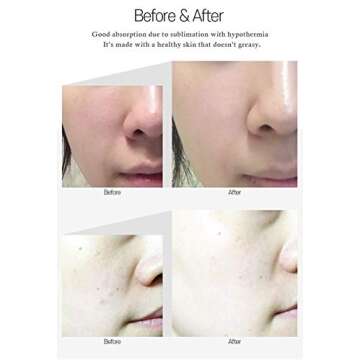 Medi-Peel 5Growth Factor Bor-Tox Peptide Ampoule 30ml, Hydrolyzed Collagen, Anti-Aging Serum, Anti-Wrinkle, Skin Elasticity, Blemish Care, Reduce Fine Lines, Hyaluronic Acid, Korean Skin Care