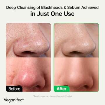 VEGANIFECT LHA Deep Cleansing Oil, Makeup, Blackhead and Whitehead Remover, Korean Skin Care, Vegan,...