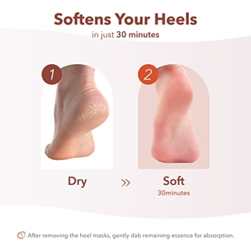 Purederm Instant Softening Heel Mask for Hydration