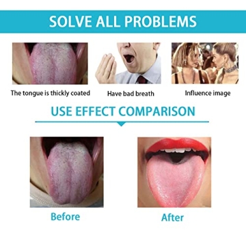 Yiwafu 2 Pack Stainless Steel Tongue Scraper for Fresh Breath