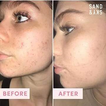 Sand & Sky Perfect Skin Kit for Blackheads, Enlarged Pores & Pigmentation | Includes Australian Pink Clay Face Mask & Facial Exfoliator