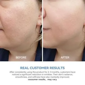 WNP Ultra-Hydrating Serum 3% Hyaluronic Acid, Skin Repair|Glass Skin|Anti-Aging serum for face, Single-Use Vials Skincare for Sensitive skin|4D Hyaluronic Acid(1.2 ml/0.04 fl.oz.)*100