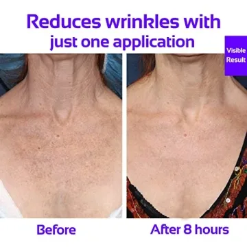 Skywee Anti Wrinkle Pads for Youthful Skin Maintenance