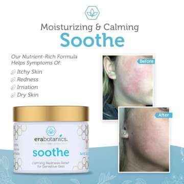 Era Organics Cream Redness Relief Moisturizer- Soothing Redness Relief for Face with Manuka Honey, MSM, Chamomile - Calming Moisturizer Made in USA