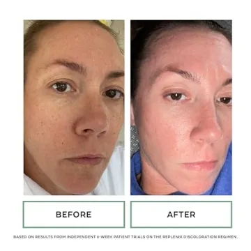 Glycolic Acid Resurfacing Peel Pads for Youthful Skin