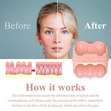 Ice Roller for Face, Ice Face Roller Skin Care Tools, 2 in 1 Face Massager Eye Roller for Puffy Eyes Migraine Relief, Reduce Wrinkles, Relieve Muscle Soreness, Relieve Sunburn and Redness, Pink