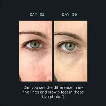 OneSkin EYE OS-01 Peptide Skin Longevity Eye Cream - Improves Skin Hydration and Firmness, For All Skin Types Including Sensitive Skin