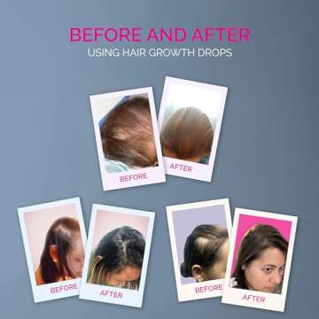 Maka Capillary Health Hair Growth Drops for Women and Men, Anti Hair Loss and Hair Regrowth Treatment with 1.5% Minoxidil and other Natural Ingredients - 4 Oz