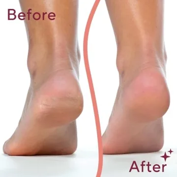 Finishing Touch Flawless Pedi Tool - Exquisite Foot Care