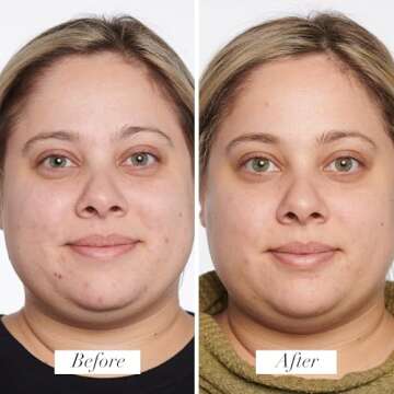 PUR Beauty 4-in-1 Correcting Primer, Anti-Blemish & Mattifying Treatment - Primer for Face Before Makeup - Primer Face Makeup for Women - Crease-Free & Matte-Finish Make Up Hydrating Primer - 1 Fl Oz