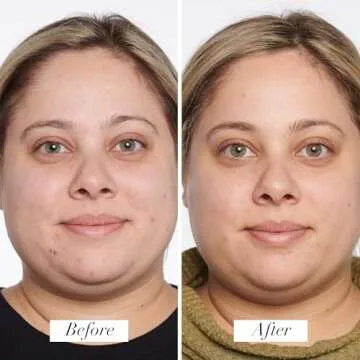 PUR Beauty 4-in-1 Correcting Primer, Anti-Blemish & Mattifying Treatment - Primer for Face Before Makeup - Primer Face Makeup for Women - Crease-Free & Matte-Finish Make Up Hydrating Primer - 1 Fl Oz