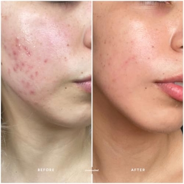 True Botanicals Clear Pure Radiance Oil for Oily Skin