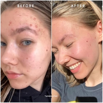 True Botanicals Clear Pure Radiance Oil for Oily Skin