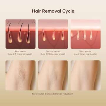 IPL Laser Hair Removal Device for Women and Men