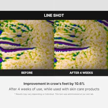 Medicube Age-R Line Shot Anti-Aging Device for Glowing Skin