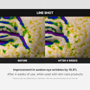 Medicube Age-R Line Shot Anti-Aging Device for Glowing Skin