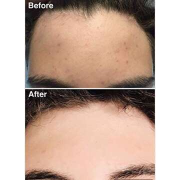 Teenology Gentle Face Cleanser for Clear Skin and Freshness